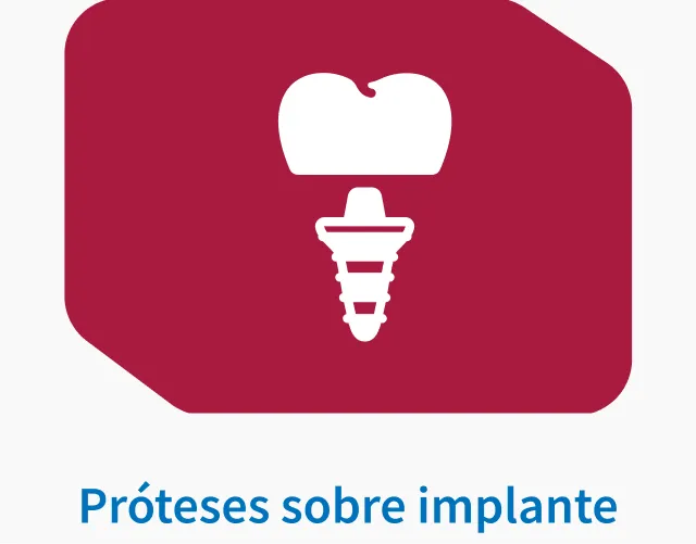 Pr&oacute;teses sobre implante