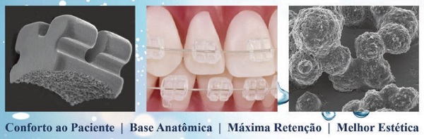  Vantagens do Kit Bráquetes Cerâmicos Safira Mini MBT 022 da Aditek  