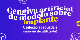 Gengiva artificial em implantes dentários: Escolha e aplicações corretas