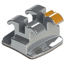 Reposição Roth Standard 0,022'' - Incisal Lateral Sup Direito Dente 12 - 10.10.202 - Morelli