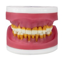 Manequim Refil Top Cirúrgia com Dentes de Pério AC 025 - Pronew