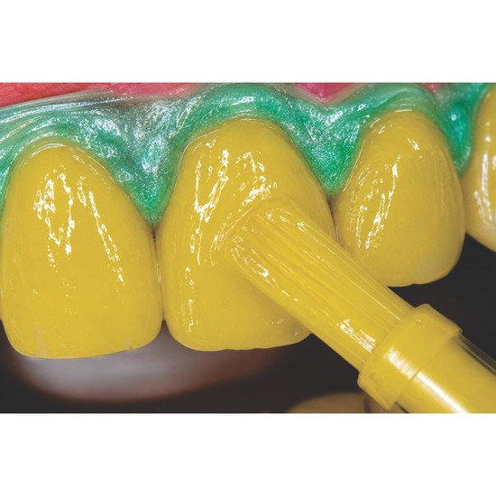 Kit Clareador Mix One Supreme 35% com Gingi Dam 3 Pacientes - Villevie