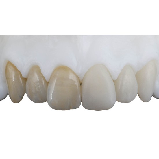 Zirlux Anterior Multilayer Para CAD/CAM